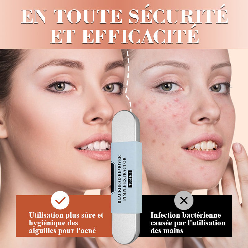 Kit d'outils de réduction pour l'extraction des points noirs et des boutons. Dernières 3 heures : Grande vente
