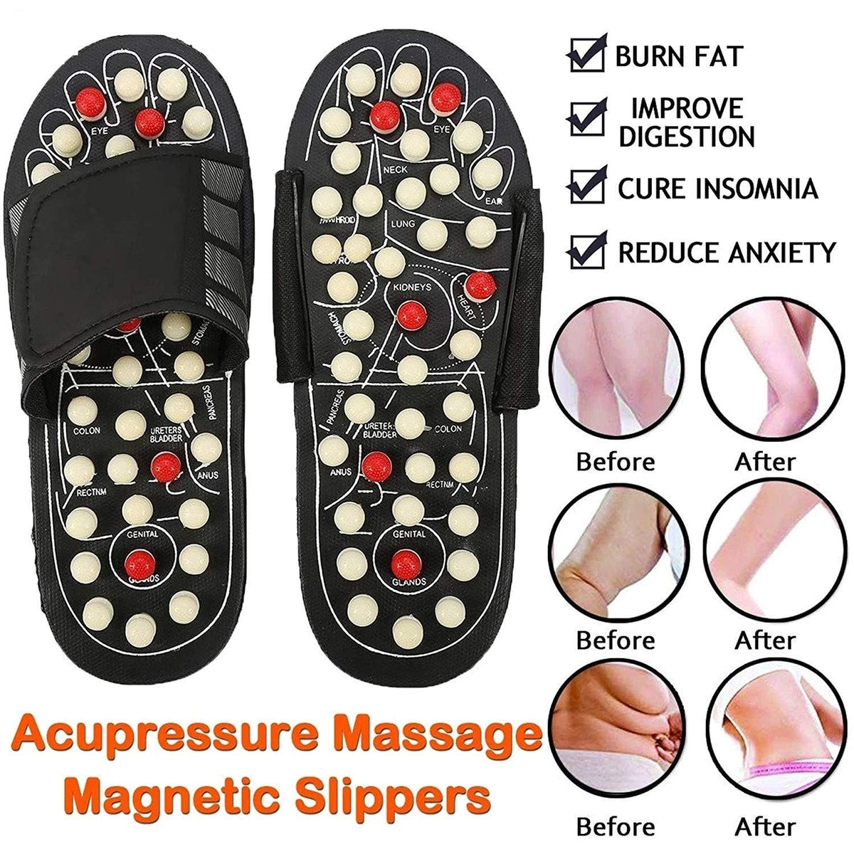 Acupressure and magnetotherapy slippers 50% OFF