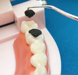 Ensemble de cure-dents en acier inoxydable | Hygiénique & Durable