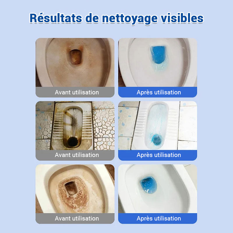 Comprimés effervescents de nettoyage pour toilettes - décontamination, tartre urinaire, alcali urinaire et élimination des odeurs