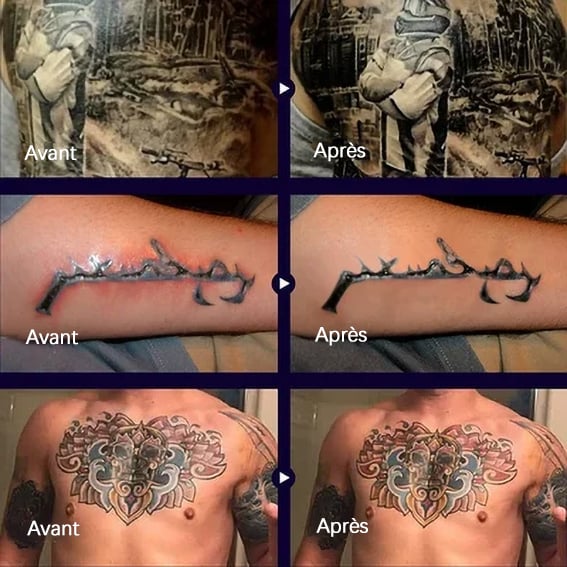 Baume éclaircissant après-soin pour tatouage