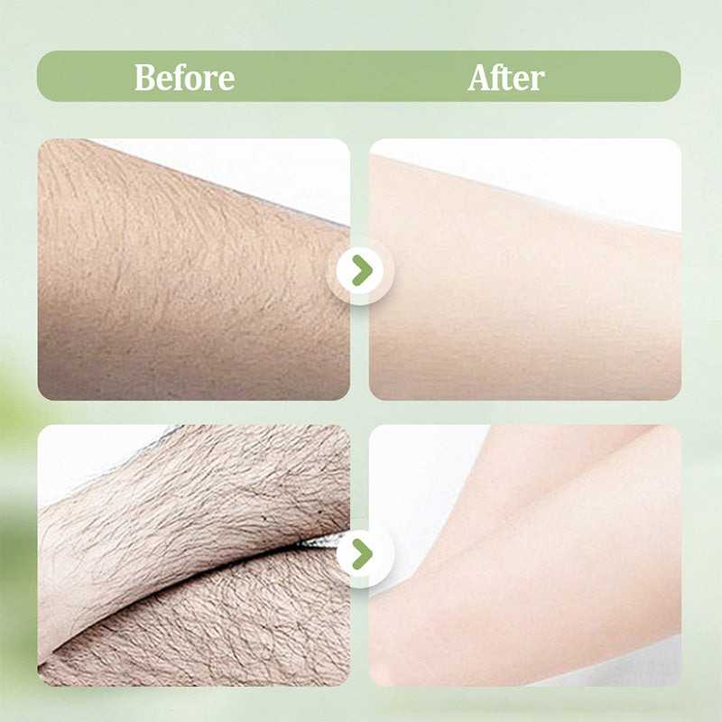 Crème dépilatoire douce et non irritante